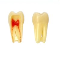 DIENTE ENDODONCIA FRASACO ANA-4 Z3RN Nº 16