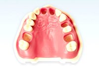 TIPODONTO MAXILAR PARA ENDODONCIA ANA4VEOK903