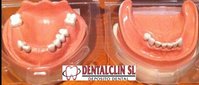 TIPODONTO PARCIALMENTE DENTADO KAVO
