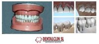 TIPODONTO PERIODONCIA KAVO